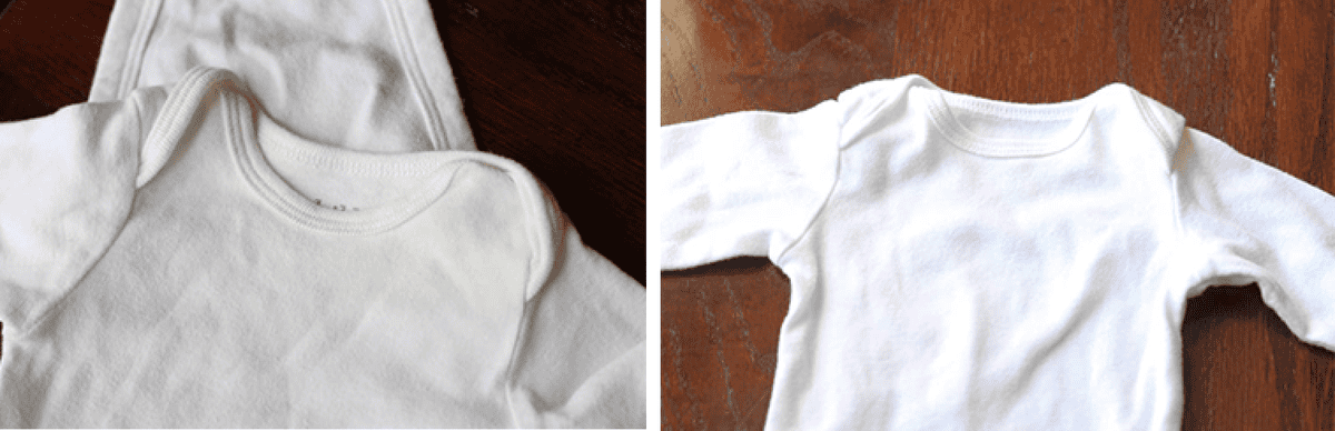 yellow stains on white shirts after washing